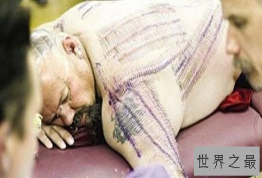 清点世界最多 印度小男孩竟有14个手指和20个脚趾