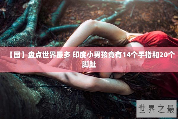 【图】盘点世界最多 印度小男孩竟有14个手指和20个脚趾