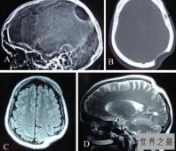 【图】关于人体骨骼的十大事实 原来人体骨骼有这么多