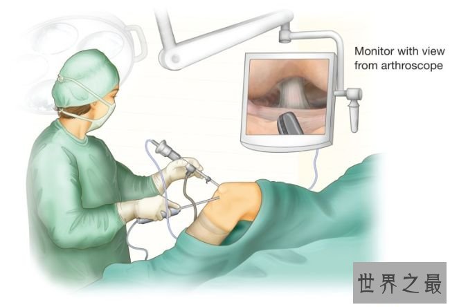 关节镜手术-一般骨科手术