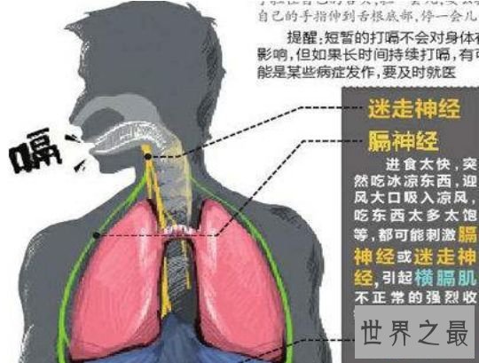 打嗝工夫最长的人，查尔斯.奥斯本每天打嗝24000次(长达68年)