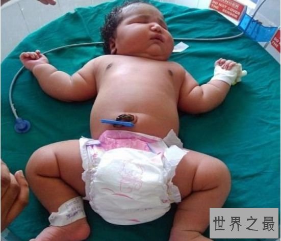 世界上最重的女婴，印度19岁母亲产下13.6斤重的女婴(重生儿的两倍)