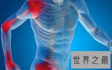 【图】世界上最痛苦的病 常见疼痛难以忍受的疾病