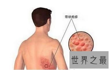 【图】世界上最痛苦的病 常见疼痛难以忍受的疾病