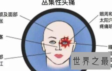 【图】世界上最痛苦的病 常见疼痛难以忍受的疾病