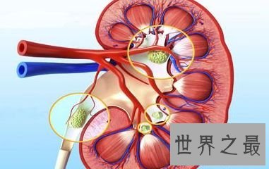 【图】世界上最痛苦的病 常见疼痛难以忍受的疾病