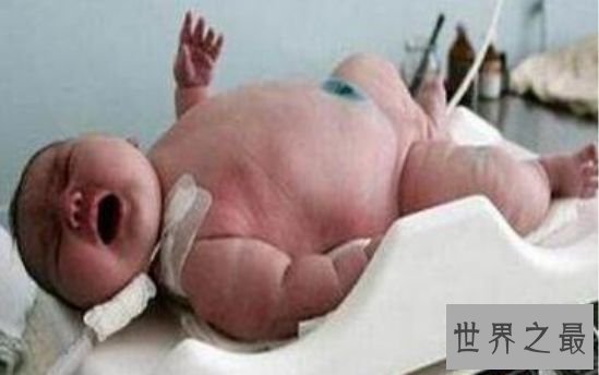 清点世界最大 吉尼斯记载中最大的脚竟长达40厘米