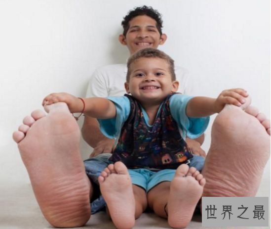 清点世界最大 吉尼斯记载中最大的脚竟长达40厘米