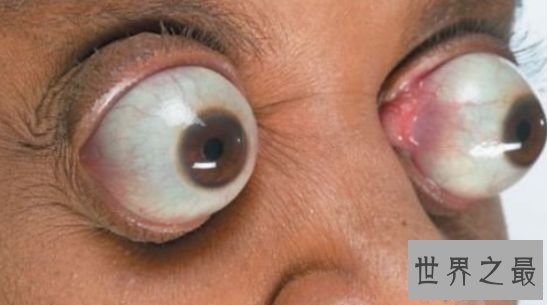 清点世界最长 印度男子左手指甲长度总和竟达9米