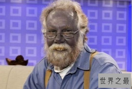 世界上最奇怪的民族 皮肤血液均为蓝色的奥坎基查尔族人 世界上最奇怪的民族 皮肤血液均为蓝色的奥坎基查尔族人