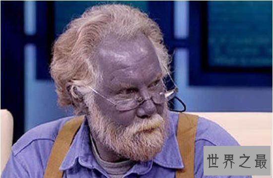 世界上最奇怪的民族 皮肤血液均为蓝色的奥坎基查尔族人 世界上最奇怪的民族 皮肤血液均为蓝色的奥坎基查尔族人