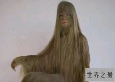 【图】世界上体毛最长的人 科学家称其为“人类返祖现