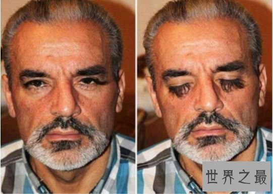 世界上体毛最长的人 科学家称其为“人类返祖现象”