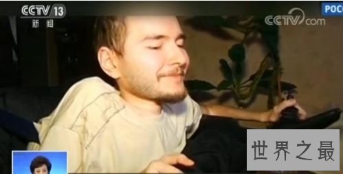 中国传授实现寰球首例人类换头术 历时18个小时