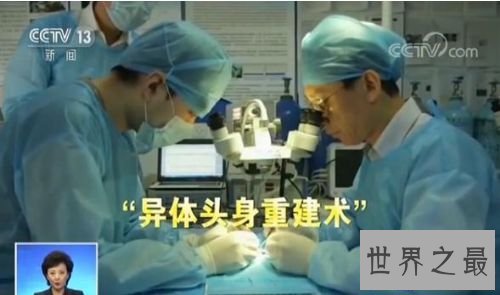 中国传授实现寰球首例人类换头术 历时18个小时