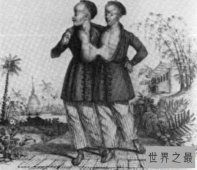 【图】世界上最著名的连体人 昂和昌的传奇一生