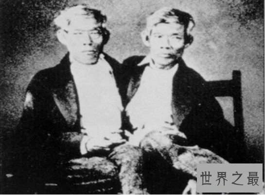 世界上最著名的连体人 昂和昌的传奇终身