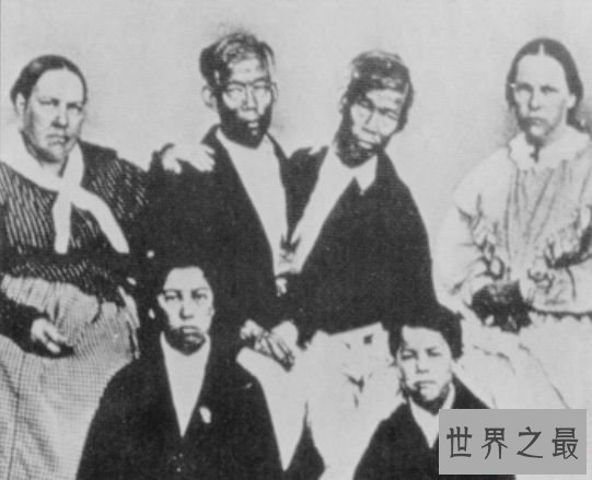 世界上最著名的连体人 昂和昌的传奇终身