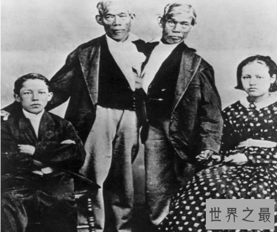 世界上最著名的连体人 昂和昌的传奇终身