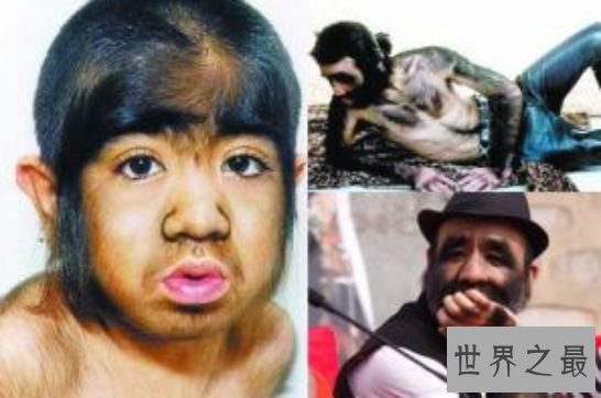 中国第一毛孩 于震寰终获真爱陪伴