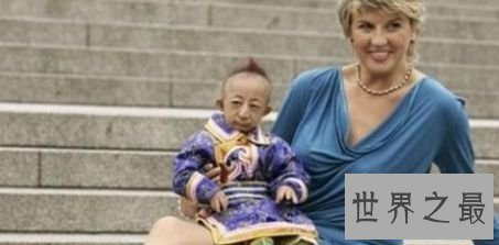 世界上最矮的人