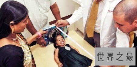 世界上最矮的人