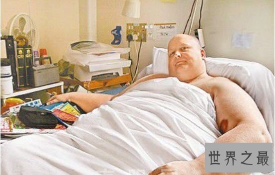 世界上最胖的人 因减掉500斤肉导致皮肤下垂重大