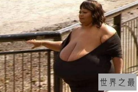 世界上最大的自然乳房 安妮·霍金斯·特纳双乳重达35.8公斤