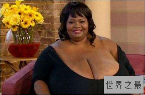 世界上最大的自然乳房 安妮·霍金斯·特纳双乳重达35.8公斤