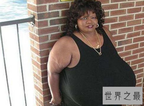 世界上最大的自然乳房 安妮·霍金斯·特纳双乳重达35.8公斤