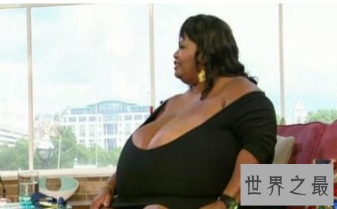 世界上最大的自然乳房 安妮·霍金斯·特纳双乳重达35.8公斤