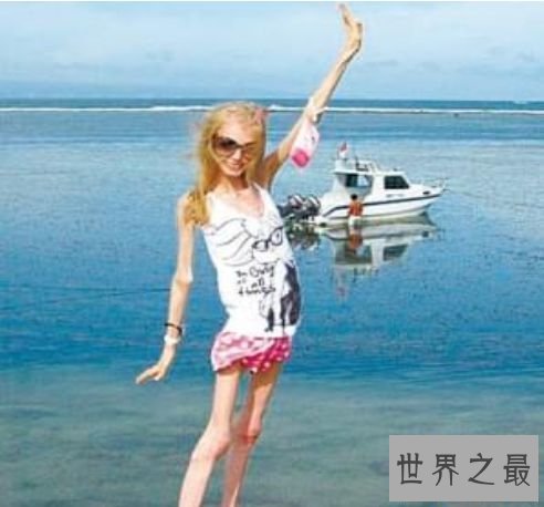 世界上最瘦的人 极其减肥形成体重仅20公斤