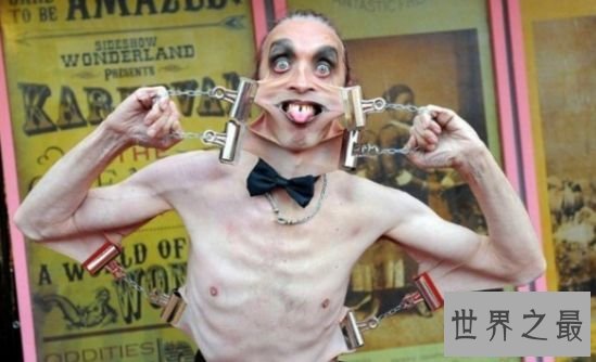 世界上皮肤最有弹性的人 加里.特纳下巴的皮肤能笼罩嘴巴