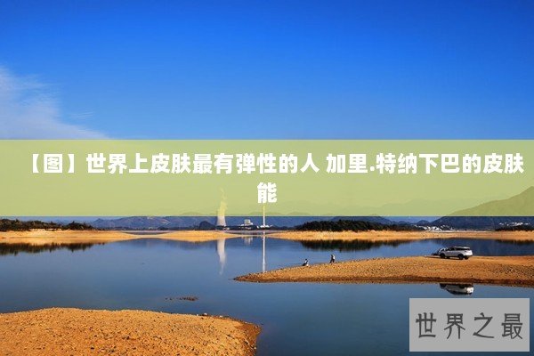 【图】世界上皮肤最有弹性的人 加里.特纳下巴的皮肤能