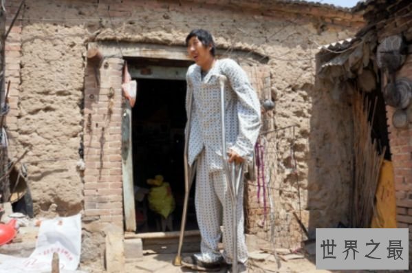 中国最高的人徐福海 仅26岁就高达2.43米