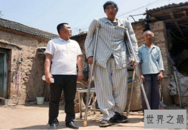 中国最高的人徐福海 仅26岁就高达2.43米