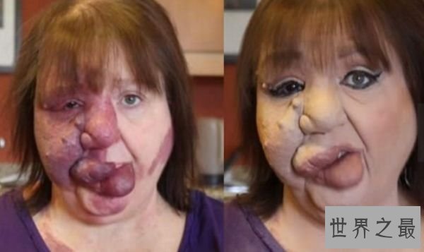 世界上最恶心的人 清点世界上最丑最恶心的人