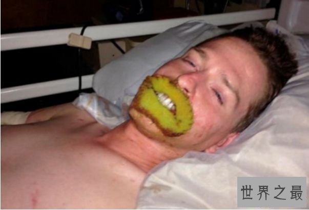 世界上最恶心的人 清点世界上最丑最恶心的人