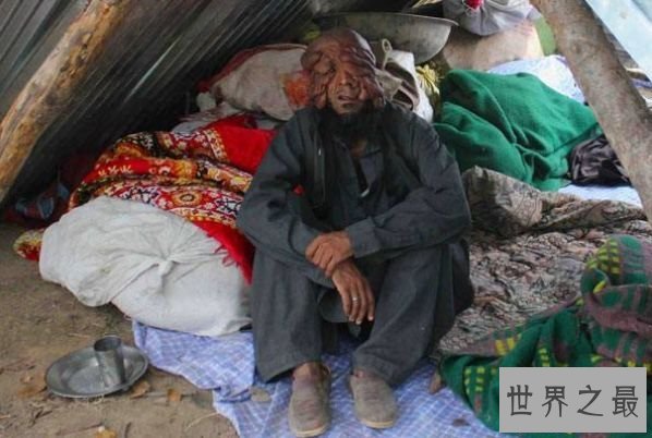 世界上最恶心的人 清点世界上最丑最恶心的人