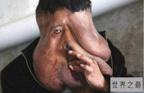 世界上最恶心的人 清点世界上最丑最恶心的人