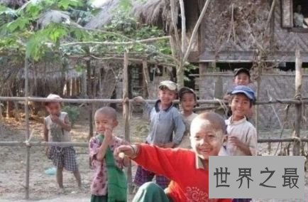 世界上最黑的人，南非婴儿黑出了新高度