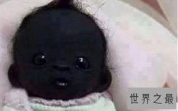 【图】世界上最黑的人 南非婴儿黑出了新高度