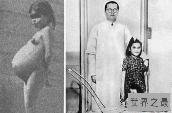 世界上最年轻的妈妈 秘鲁女孩琳娜.梅迪纳5岁产子