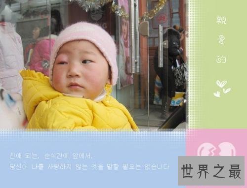 【图】眼睛长了麦粒肿图片 麦粒肿的缘由以及如何处理