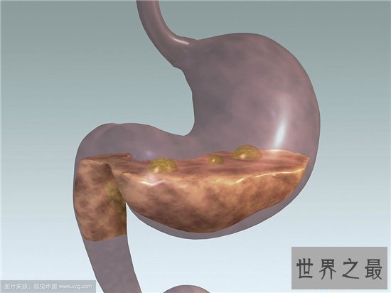 【图】人体器官图由五脏六腑组成 分别协助人体完成各