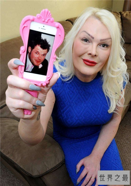 【图】金星自传形容变性手术过程 手术完结后体重少