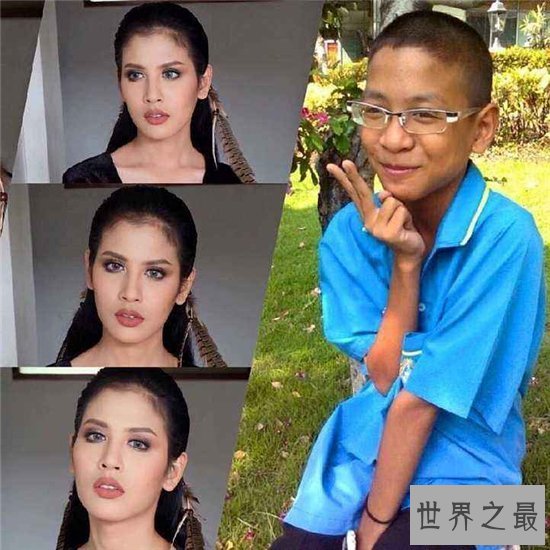 【图】金星自传形容变性手术过程 手术完结后体重少