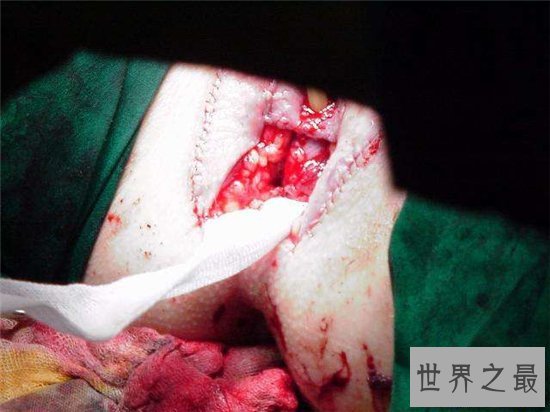 【图】金星自传形容变性手术过程 手术完结后体重少