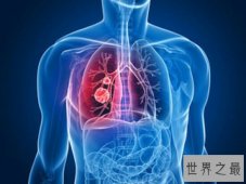 【图】人体内脏图，左下腹器官竟然是分男女的
