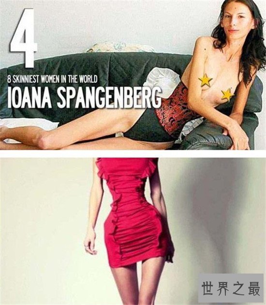 【图】世界上最瘦的人 不要盲目节食减肥损伤身材